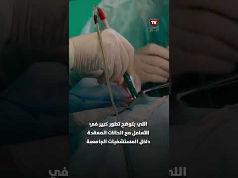 نجاح استخراج 100 جسم معدني من معدة مريض بمنظار طبي في بني سويف